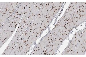ABIN6267591 at 1/200 staining human Smooth muscle tissue sections by IHC-P. (MEF2A Antikörper  (pThr319))