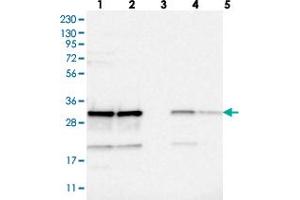 Western blot analysis of Lane 1: RT-4, Lane 2: U-251 MG, Lane 3: Human Plasma, Lane 4: Liver, Lane 5: Tonsil with CCDC43 polyclonal antibody  at 1:250-1:500 dilution. (CCDC43 Antikörper)