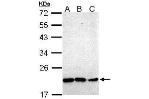 WB Image Sample (30 ug of whole cell lysate) A: Hep G2 , B: Molt-4 , C: Raji 12% SDS PAGE antibody diluted at 1:1000 (NKX2-8 Antikörper)