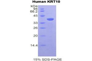 SDS-PAGE (SDS) image for Keratin 10 (KRT10) (AA 153-456) protein (His tag) (ABIN2121479)