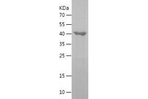 Western Blotting (WB) image for GTP Binding Protein 3 (Mitochondrial) (GTPBP3) (AA 282-492) protein (His-IF2DI Tag) (ABIN7123224) (GTPBP3 Protein (AA 282-492) (His-IF2DI Tag))