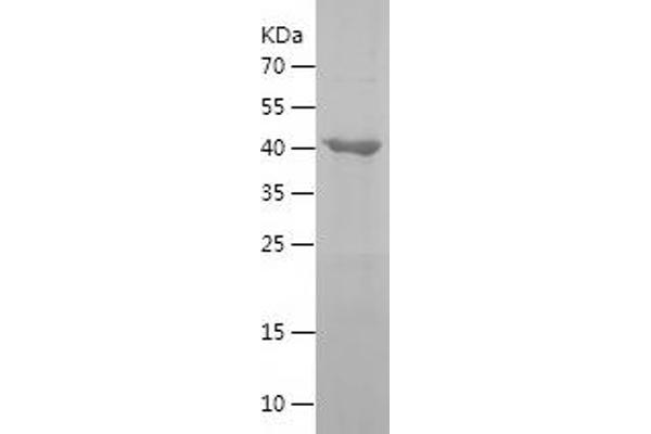 GTPBP3 Protein (AA 282-492) (His-IF2DI Tag)