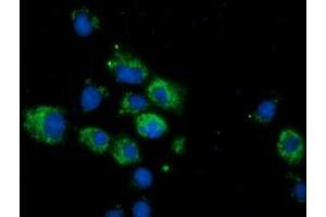 Anti-CALCOCO2 mouse monoclonal antibody (ABIN2453914) immunofluorescent staining of COS7 cells transiently transfected by pCMV6-ENTRY CALCOCO2 (RC203843). (CALCOCO2 Antikörper)
