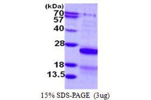 Image no. 1 for Cysteine and Glycine-Rich Protein 2 (CSRP2) protein (His tag) (ABIN1098276) (CSRP2 Protein (His tag))