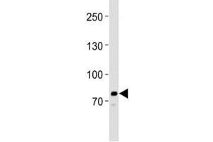 Western blot analysis of lysate from HeLa cell line using anti-PCSK9 antibody at 1:1000. (PCSK9 Antikörper  (AA 479-508))