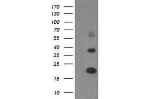 Image no. 5 for anti-Malignant T Cell Amplified Sequence 1 (MCTS1) (AA 1-181) antibody (ABIN1490598) (MCTS1 Antikörper  (AA 1-181))