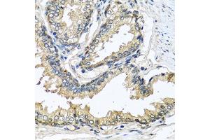 Immunohistochemistry of paraffin-embedded human prostate using CST1 antibody (ABIN5975714) at dilution of 1/100 (40x lens). (CST1 Antikörper)
