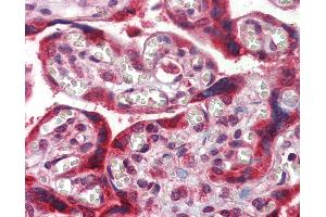 Anti-TMC8 / EVER2 antibody IHC of human placenta. (TMC8 Antikörper  (Internal Region))