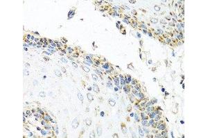 Immunohistochemistry of paraffin-embedded Human esophagus using GNRH2 Polyclonal Antibody at dilution of 1:100 (40x lens). (GnRH2 Antikörper)