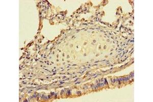 Immunohistochemistry of paraffin-embedded human lung tissue using ABIN7142194 at dilution of 1:100 (26S Proteasome Complex Subunit SEM1 (SEM1) (AA 1-70) Antikörper)