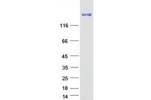 Validation with Western Blot (Laminin gamma 1 Protein (Myc-DYKDDDDK Tag))