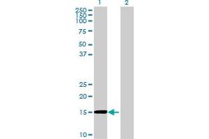 Western Blot analysis of RAG1AP1 expression in transfected 293T cell line ( H00055974-T01 ) by RAG1AP1 MaxPab polyclonal antibody. (SLC50A1 Antikörper  (AA 1-167))