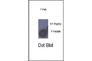 Dot blot analysis of anti-Phospho-Rb- Antibody (ABIN389644 and ABIN2839636) on nitrocellulose membrane. (Retinoblastoma 1 Antikörper  (pSer780))