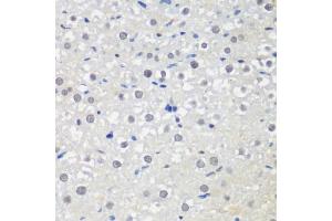 Immunohistochemistry of paraffin-embedded rat liver using CTCF antibody (ABIN6130043, ABIN6139180, ABIN6139182 and ABIN6217207) at dilution of 1:200 (40x lens). (CTCF Antikörper  (AA 1-260))