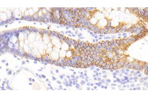 Immunohistochemistry (IHC) image for anti-Keratin 13 (KRT13) (AA 104-403) antibody (ABIN7434251)