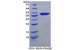 SDS-PAGE (SDS) image for Kininogen 1 (KNG1) (AA 390-644) protein (His tag) (ABIN1980911)