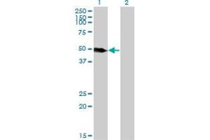 Western Blot analysis of LSP1 expression in transfected 293T cell line by LSP1 monoclonal antibody (M07), clone 1C4. (LSP1 Antikörper  (AA 240-338))
