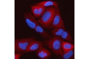 IF analysis of RAP1GAP using anti-RAP1GAP antibody (ABIN7599729). (RAP1GAP Antikörper  (AA 11-661))