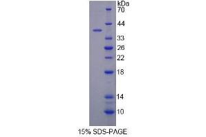 SDS-PAGE analysis of Human COX6c Protein.