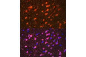 Immunofluorescence analysis of mouse brain cells using TBR1 Rabbit mAb (ABIN7270703) at dilution of 1:100 (40x lens). (TBR1 Antikörper)