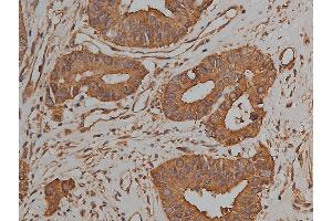 Immunohistochemistry (IHC) image for anti-Junction Plakoglobin (JUP) (C-Term) antibody (ABIN6260497)