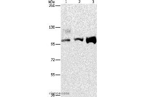 Western blot analysis of A431, 293T and hela cell, using ASCC2 Polyclonal Antibody at dilution of 1:500