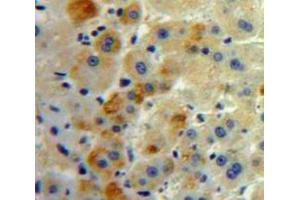 Used in DAB staining on fromalin fixed paraffin-embedded Liver tissue (FAS Antikörper  (AA 22-169))