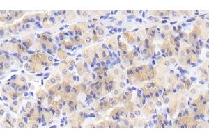 Detection of CASP2 in Human Stomach Tissue using Polyclonal Antibody to Caspase 2 (CASP2)