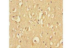 Immunohistochemistry of paraffin-embedded human brain tissue using ABIN7167749 at dilution of 1:100 (RTN4RL1 Antikörper  (AA 201-420))