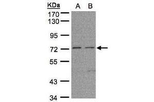 WB Image Sample (30μg whole cell lysate) A: H1299 B: HeLa S3, 7. (FLRT1 Antikörper)