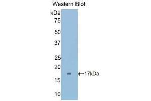 Western Blotting (WB) image for anti-Cubilin (Intrinsic Factor-Cobalamin Receptor) (CUBN) (AA 3157-3274) antibody (ABIN1175677) (CUBN Antikörper  (AA 3157-3274))