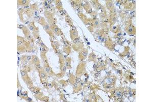 Immunohistochemistry of paraffin-embedded Human stomach using STX7 Polyclonal Antibody at dilution of 1:100 (40x lens). (Syntaxin 7 Antikörper)