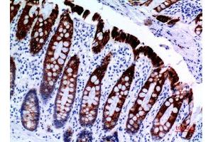 Immunohistochemistry (IHC) image for anti-Keratin 8 (KRT8) (Ser726), (Ser731) antibody (ABIN3187841)