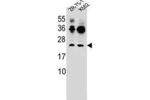 Western Blotting (WB) image for anti-Frequently Rearranged in Advanced T-Cell Lymphomas 2 (FRAT2) antibody (ABIN2996405)