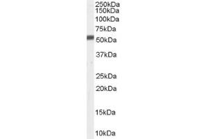 Image no. 1 for anti-Zinc Metalloproteinase, Ste24 (Zmpste24) (C-Term) antibody (ABIN374738) (ZMPSTE24 Antikörper  (C-Term))