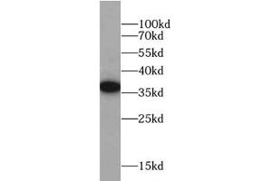 Western blot analysis of HeLa cells subjected to SDS-PAGE, using FOLR1 antibody (1/1000 dilution). (FOLR1 Antikörper)