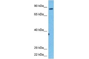 Host:  Rabbit  Target Name:  KIF2C  Sample Tissue:  Human Stomach Tumor  Antibody Dilution:  1ug/ml (KIF2C Antikörper  (C-Term))