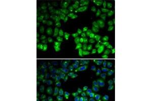 Immunofluorescence analysis of U2OS cells using NEIL1 Polyclonal Antibody (NEIL1 Antikörper)