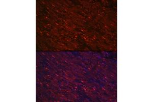 Immunofluorescence analysis of rat heart using PG Rabbit pAb (ABIN6132481, ABIN6145500, ABIN6145501 and ABIN6223912) at dilution of 1:100 (40x lens). (PGAM2 Antikörper  (AA 1-253))
