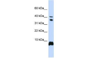 WB Suggested Anti-HMGN1 Antibody Titration:  0. (HMGN1 Antikörper  (Middle Region))
