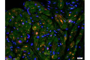 Formalin-fixed and paraffin-embedded rat cardiac muscle labeled with Anti-M Cadherin Polyclonal Antibody, Unconjugated (ABIN719831) 1:200, overnight at 4°C, The secondary antibody was Goat Anti-Rabbit IgG, Cy3 conjugated used at 1:200 dilution for 40 minutes at 37°C. (CDH15 Antikörper  (AA 355-450))