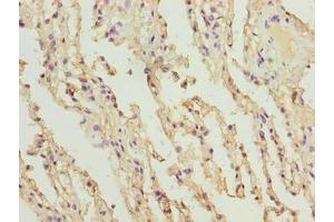 Immunohistochemistry of paraffin-embedded human lung tissue using ABIN7148227 at dilution of 1:100 (COL12A1 Antikörper  (AA 140-316))