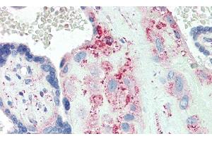 Immunohistochemistry (IHC) image for anti-Proteoglycan 4 (PRG4) (AA 1151-1241) antibody (ABIN7436231)
