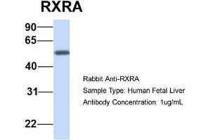 Host:  Rabbit  Target Name:  RXRA  Sample Type:  Human Fetal Liver  Antibody Dilution:  1. (Retinoid X Receptor alpha Antikörper  (N-Term))