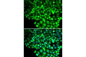 Immunofluorescence analysis of HeLa cells using ALOX15B antibody. (ALOX15B Antikörper)