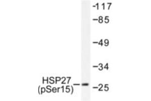 Image no. 1 for anti-Heat Shock 27kDa Protein 1 (HSPB1) (pSer15) antibody (ABIN318042) (HSP27 Antikörper  (pSer15))