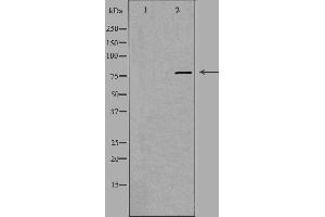 Western blot analysis of extracts from A549 cells, using EHHADH antibody.