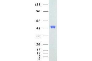 Western Blotting (WB) image for V-Ets erythroblastosis Virus E26 Oncogene Homolog 1 (Avian) (ETS1) (Transcript Variant 2) (Active) protein (Myc-DYKDDDDK Tag) (ABIN2720575)