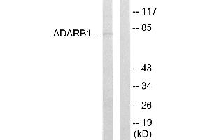 Western blot analysis of extracts from HepG2 cells, using ADARB1 antibody. (RED1 Antikörper)