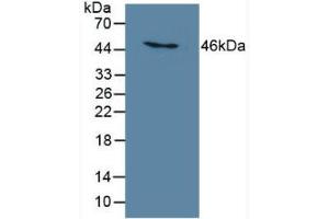 Detection of MB21D1 in Human THP-1 Cells using Polyclonal Antibody to Mab21 Domain Containing Protein 1 (MB21D1)
